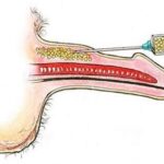 penis enlargement fillers fat grafting in nepal